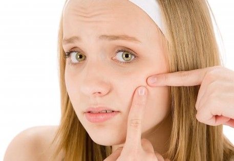 24 ефективних патча для швидкого локального видалення акне і гнійників COSRX Acne Pimple Master Patch